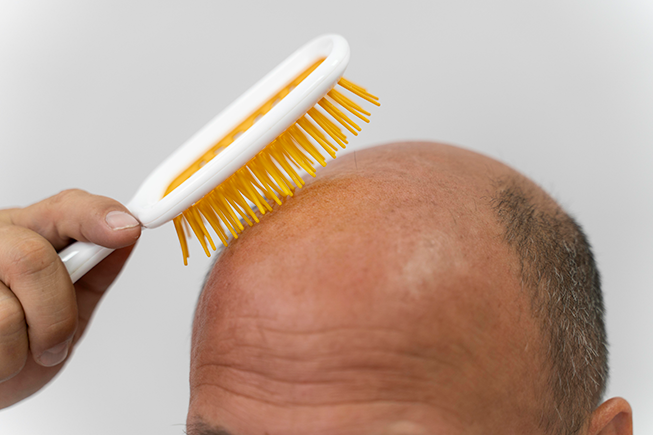 <a href='https://www.freepik.com/photos/hair-transplant'>Hair transplant photo created by freepik - www.freepik.com</a> <a href='https://www.freepik.com/photos/hair-transplant'>Hair transplant photo created by freepik - www.freepik.com</a>
